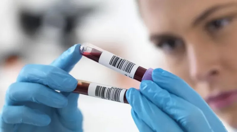 Аналіз крові покаже, як швидко старіють наші органи