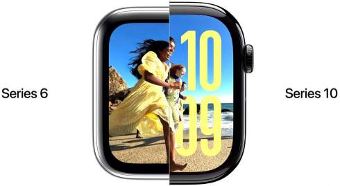  Apple Watch 10        